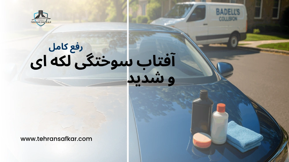 مراحل رفع آفتاب سوختگی لکه ای و شدید